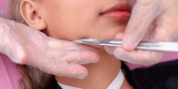 Is Dermaplaning Good for Your Face? What to Know Before You Try It
